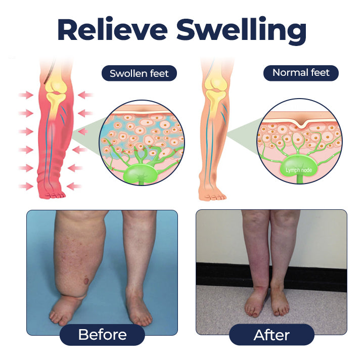 VIXIRUS® SwellRelief Circulation Support Cream