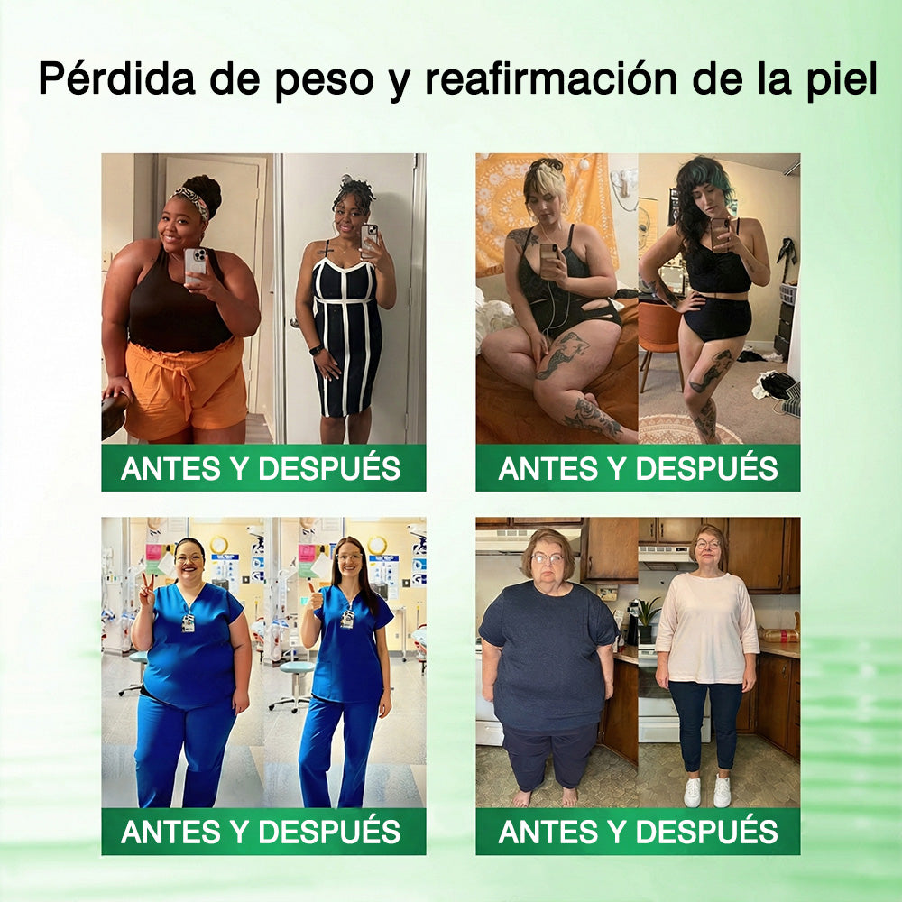 🥇🥇𝑻𝒊𝒆𝒏𝒅𝒂 𝑶𝒇𝒊𝒄𝒊𝒂𝒍 |  𝑴𝒐𝒓𝒊𝒏𝒈𝒂 · 𝑩𝒆𝒓𝒃𝒆𝒓𝒊𝒏𝒂 × 𝑵𝑨𝑫+ 𝑷𝒂𝒕𝒄𝒉 𝒂𝒗𝒂𝒏𝒛𝒂𝒅𝒐 𝟏𝟎-𝒆𝒏-𝟏 𝒄𝒐𝒏 𝒏𝒂𝒏𝒐 𝒎𝒊𝒄𝒓𝒐𝒂𝒈𝒖𝒋𝒂𝒔