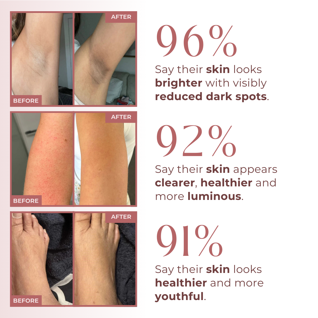 Peel Shot - Kojic + Turmeric Body Peel Spray