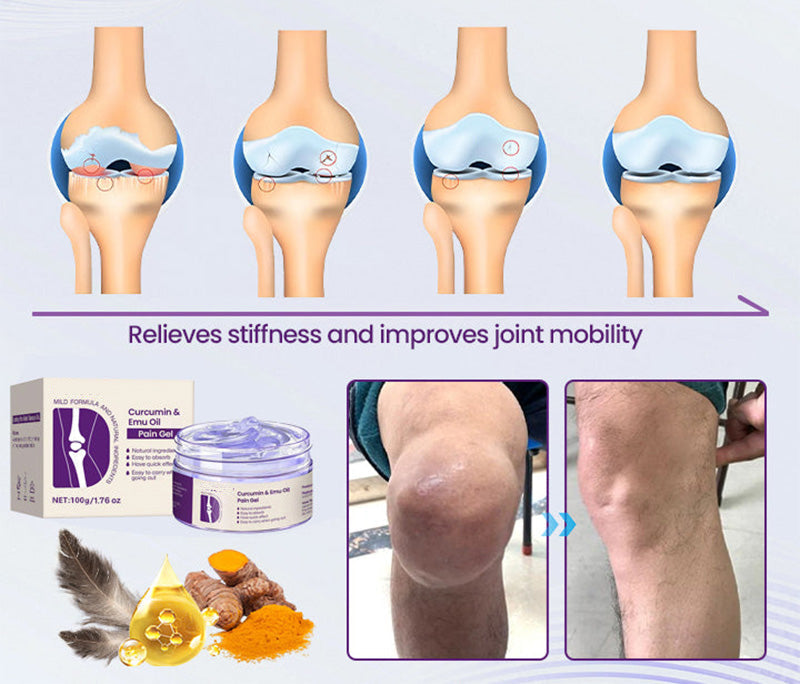 Aurenvi™ Curcumin & Emu Oil Pain Gel – 🏥Backed by US Osteopathic Experts