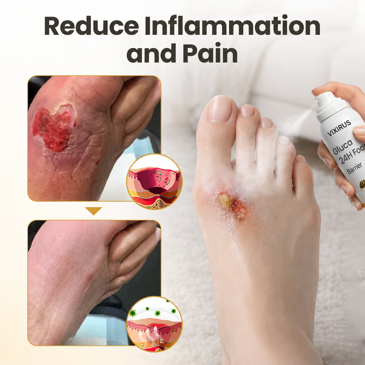 VIXIRUS® GlucaVeil 24H Foot Barrier Spray