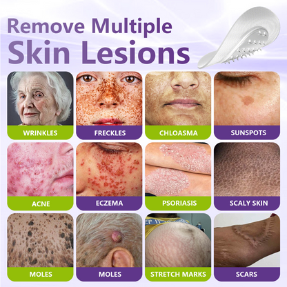 VIXIRUS® Soluble Microneedle Botanical Skin Tag Removal Patch