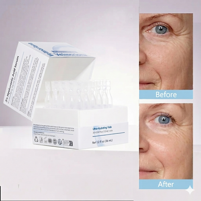✅Youthful Looking Skin in 30 Days-VIXIRUS® 3% Hyaluronic Acid Ultra Hydrating Serum Deep Hydration. Fresh Glow.