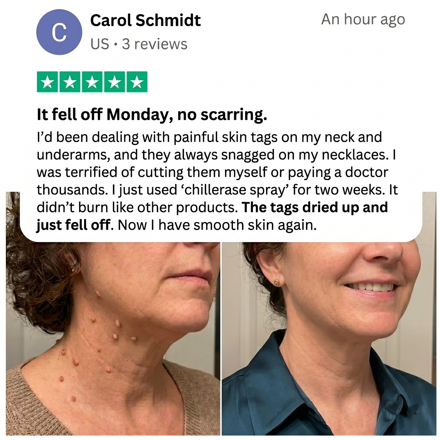 VIXIRUS® Bump Renewal Spray