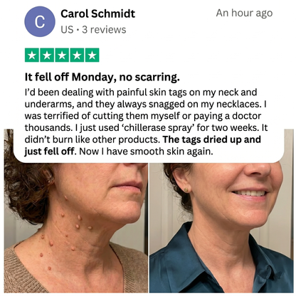 VIXIRUS® Bump Renewal Spray