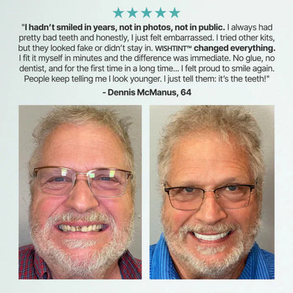 🌎Ends Today: 70% OFF! ⏰Aurenvi™ Medical Full Denture with Strong Suctiond🦷American Dental Association(ADA) Certification✅
