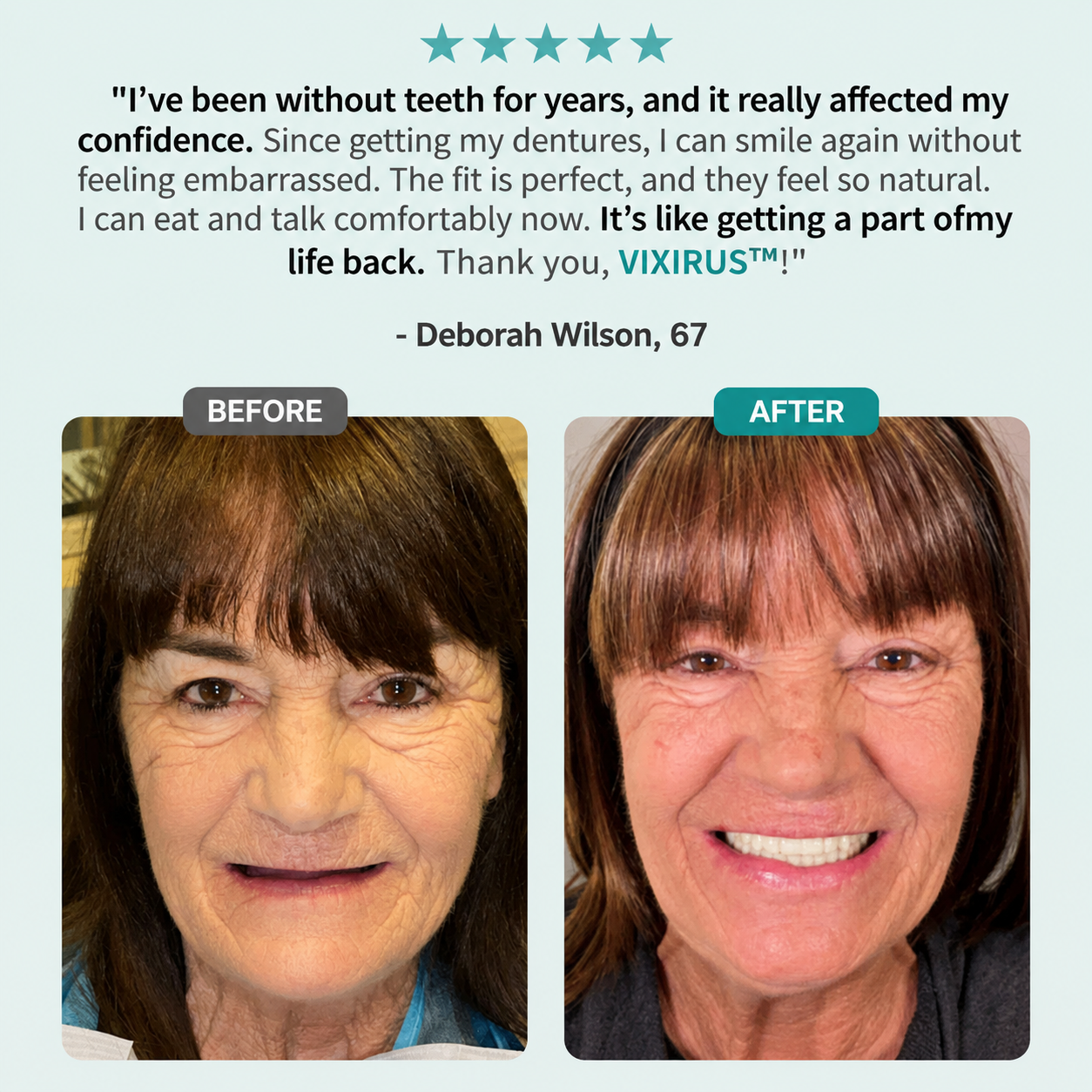 🌎Ends Today: 70% OFF! ⏰VIXIRUS™ Medical Full Denture with Strong Suctiond🦷Obtain American Dental Association (ADA) Certification
