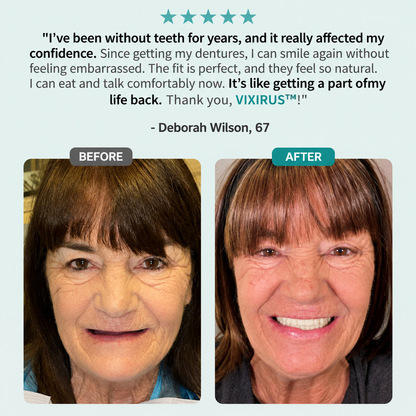 🌎Ends Today: 70% OFF! ⏰VIXIRUS™ Medical Full Denture with Strong Suctiond🦷Obtain American Dental Association (ADA) Certification