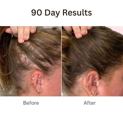 Aurenvi® The Natural 4in1 Hair Restoring Brush