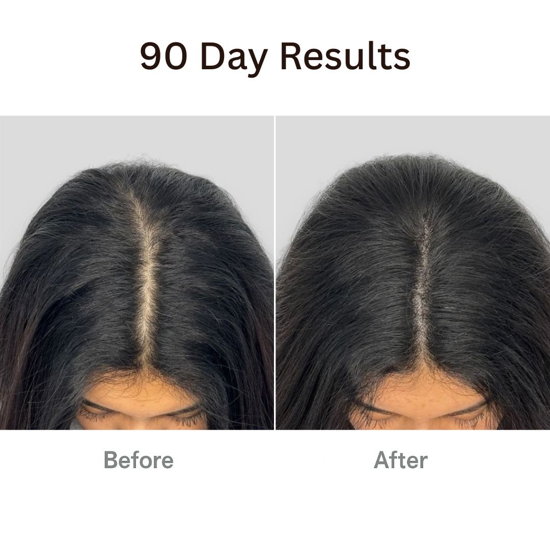 Aurenvi® The Natural 4in1 Hair Restoring Brush