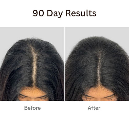 Aurenvi® The Natural 4in1 Hair Restoring Brush